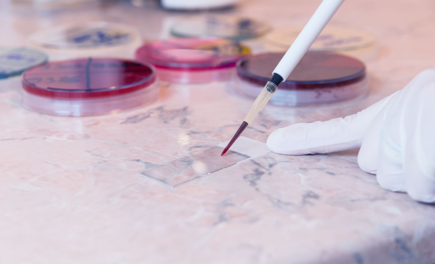 Paludisme Recherche Science
