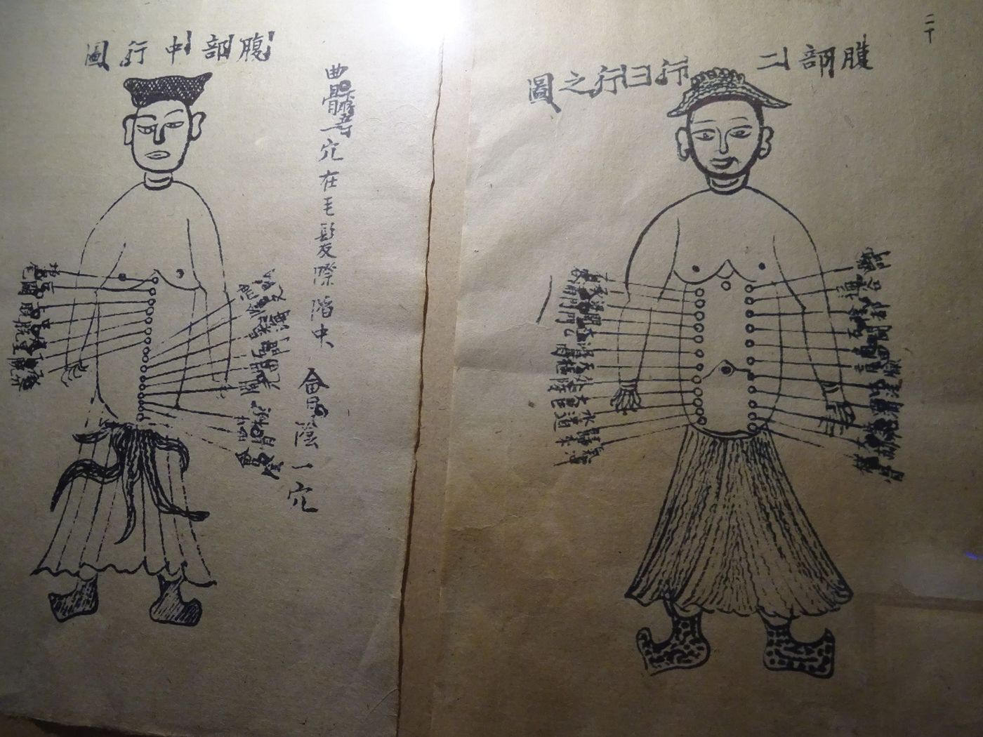 Vietnam Acupuncture